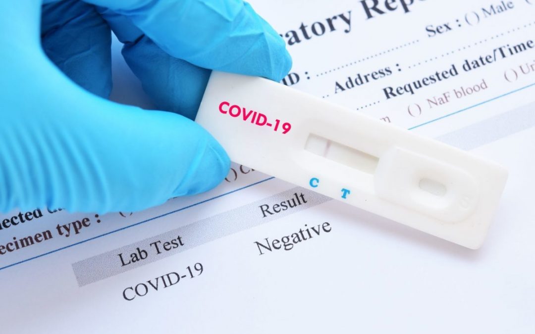 The Dominating Test for COVID-19 on the Market, and How MCI can Supply You With Them