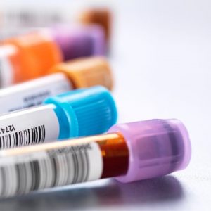 Syphilis Test