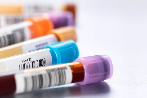 Syphilis Test